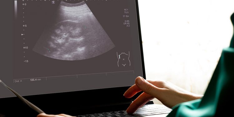 La ESA confía en GMV para vigilar la salud de los astronautas